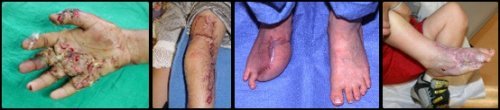 home security devices mower injuries